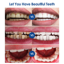 Load image into Gallery viewer, Ultrasonic Visual Dental Cleaning Teeth Whitening Kit
