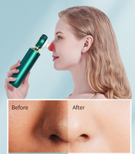Load image into Gallery viewer, Portable Visual Blackhead Remover Household USB Electric
